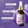 SADOER Nicotinamide Brightening Freckle Essence – 30ml